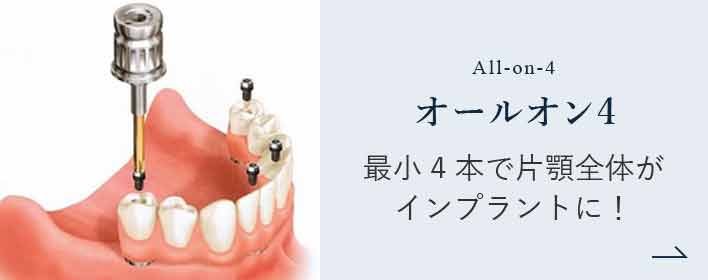 オールオン4